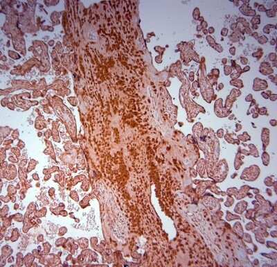 Immunohistochemistry-Paraffin SRD5A2 Antibody