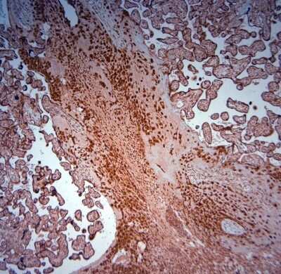 Immunohistochemistry-Paraffin: SRD5A2 Antibody [NBP1-46510] - IHC-P on paraffin sections of human placenta. HIER: Tris-EDTA, pH 9 for 20 min. Blocking: 0.2% LFDM in TBST filtered thru 0.2 um.Detection was done using HRP polymer following manufacturers instructions; DAB chromogen.Primary antibody: dilution 1: 1000, incubated 30 min at RT using Autostainer.Sections were counterstained with Harris Hematoxylin.