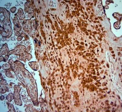 Immunohistochemistry-Paraffin: SRD5A2 Antibody [NBP1-46510] - IHC-P on paraffin sections of human placenta. HIER: Tris-EDTA, pH 9 for 20 min. Blocking: 0.2% LFDM in TBST filtered thru 0.2 um.Detection was done using HRP polymer following manufacturers instructions; DAB chromogen.Primary antibody: dilution 1: 1000, incubated 30 min at RT using Autostainer.Sections were counterstained with Harris Hematoxylin.