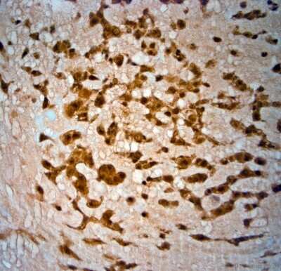 Immunohistochemistry-Paraffin: SRD5A2 Antibody [NBP1-46510] - IHC-P on paraffin sections of human placenta. HIER: Tris-EDTA, pH 9 for 20 min. Blocking: 0.2% LFDM in TBST filtered thru 0.2 um.Detection was done using HRP polymer  following manufacturers instructions; DAB chromogen.Primary antibody: dilution 1: 1000, incubated 30 min at RT using Autostainer.Sections were counterstained with Harris Hematoxylin.