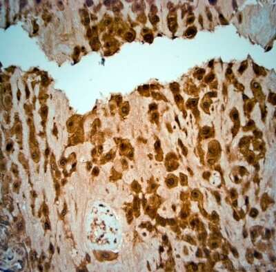 Immunohistochemistry-Paraffin: SRD5A2 Antibody [NBP1-46510] - IHC-P on paraffin sections of human placenta. HIER: Tris-EDTA, pH 9 for 20 min. Blocking: 0.2% LFDM in TBST filtered thru 0.2 um.Detection was done using HRP polymer from  manufacturers instructions; DAB chromogen.Primary antibody: dilution 1: 1000, incubated 30 min at RT using Autostainer.Sections were counterstained with Harris Hematoxylin.