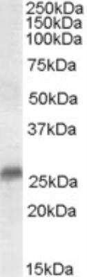 Western Blot: SRD5A2 Antibody [NB300-981] - Staining of Human Prostate lysate (35 ug protein in RIPA buffer). Primary incubation was 1 hour. Detected by chemiluminescence.