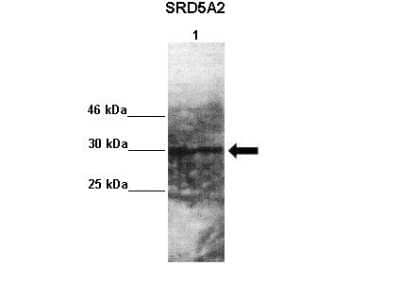 Western Blot: SRD5A2 Antibody [NBP1-59525] - Lanes: Lane 1 : 50ug monkey brain extract Primary Antibody Dilution: 1 : 1000 Secondary Antibody: Goat anti rabbit-HRP Secondary Antibody Dilution: 1 : 10,000.