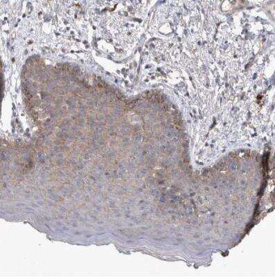 Immunohistochemistry-Paraffin: SRD5A3 Antibody [NBP1-82259] -  Staining of human skin shows weak granular cytoplasmic positivity squamous epithelial cells.