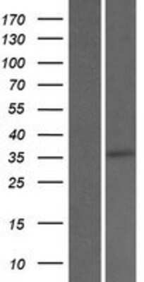 Western Blot SRD5A3 Overexpression Lysate