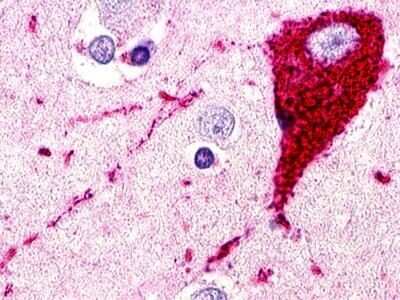 Immunohistochemistry-Paraffin: SREB3 Antibody [NLS516] - Analysis of anti-GPR173 antibody with human brain, neuron.