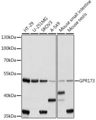 Western Blot: SREB3 Antibody [NBP2-93961] - Analysis of extracts of various cell lines, using SREB3 at 1:1000 dilution.Secondary antibody: HRP Goat Anti-Rabbit IgG (H+L) at 1:10000 dilution.Lysates/proteins: 25ug per lane.Blocking buffer: 3% nonfat dry milk in TBST.Detection: ECL Basic Kit .Exposure time: 10s.
