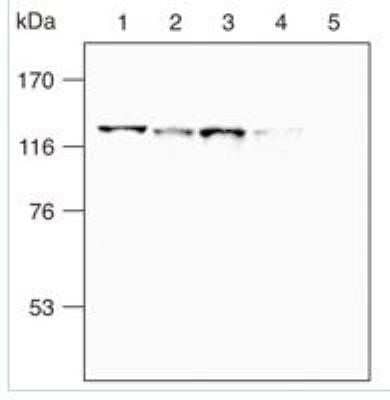 Western Blot: SREBP2 Antibody (1D2) - Azide and BSA Free [NBP2-80960] - Lane1: HEp-2 cells. Lane 2: MCF-7 cells. Lane 3: LNCaP cells. Lane 4: HT1080 cells. Lane 5: ZR75-1 cells. Image from the standard format of this antibody.