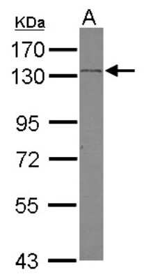 Western Blot: SREBP2 Antibody [NBP2-20481] - Sample (30 ug of whole cell lysate) A: HeLa 7. 5% SDS PAGE gel, diluted at 1:500.