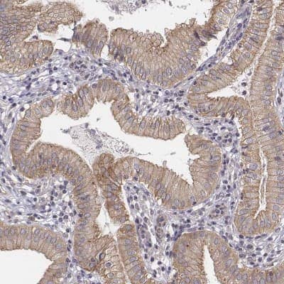 Immunohistochemistry-Paraffin: SREC-I/SCARF1 Antibody [NBP2-57396] - Immunohistochemical staining of human gallbladder shows membranous positivity in glandular cells.