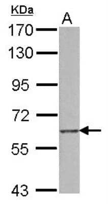 Western Blot: SREC-I/SCARF1 Antibody [NBP2-20266] - Sample (15 ug of whole cell lysate) A: HUVEC 7. 5% SDS PAGE gel, diluted at 1:2000.