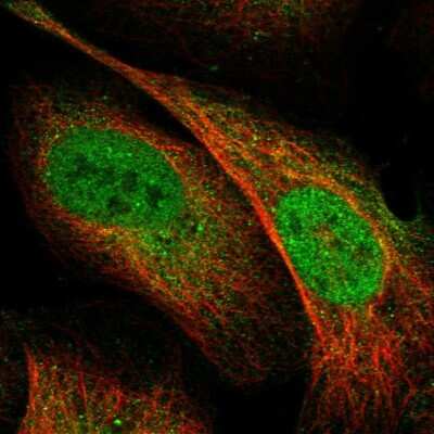 Immunocytochemistry/ Immunofluorescence SREC-II/SCARF2 Antibody