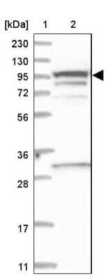 Western Blot SREC-II/SCARF2 Antibody