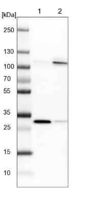 Western Blot: SREC-II/SCARF2 Antibody [NBP1-83140] - Lane 1: NIH-3T3 cell lysate (Mouse embryonic fibroblast cells). Lane 2: NBT-II cell lysate (Rat Wistar bladder tumor cells).