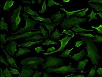 Immunocytochemistry/Immunofluorescence: SRGAP1 Antibody (5D10) [H00057522-M07] - Analysis of monoclonal antibody to SRGAP1 on HeLa cell. Antibody concentration 10 ug/ml