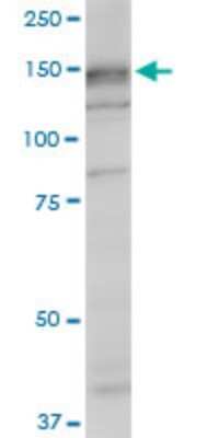 Western Blot: SRGAP1 Antibody (5D10) [H00057522-M07] - Analysis of SRGAP1 expression in NIH/3T3 (Cat # L018V1).