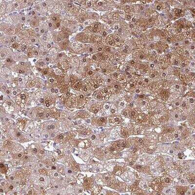 Immunohistochemistry-Paraffin: SRGAP1 Antibody [NBP2-13377] - Staining of human liver shows strong cytoplasmic and nuclear positivity in hepatocytes.