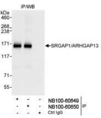Immunoprecipitation: SRGAP1 Antibody [NB100-60649] - Detection of Human SRGAP1 by Western Blot of Immunoprecipitates. Samples: Whole cell lysate (1 mg for IP, 20% of IP loaded) from HeLa cells. Antibodies: Affinity purified rabbit anti-SRGAP1/ARHGAP13 antibody NB100-60649 5Aused for IP at 3 mcg/mg lysate. SRGAP1/ARHGAP13 was also immunoprecipitated by rabbit anti-SRGAP1/ARHGAP13 antibody NB100-60650, which recognizes a downstream epitope. Detection: Chemiluminescence with an exposure time of 1 second.