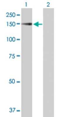 Western Blot: SRGAP1 Antibody [H00057522-B01P] - Analysis of SRGAP1 expression in transfected 293T cell line by SRGAP1 polyclonal antibody.  Lane 1: SRGAP1 transfected lysate(119.35 KDa). Lane 2: Non-transfected lysate.
