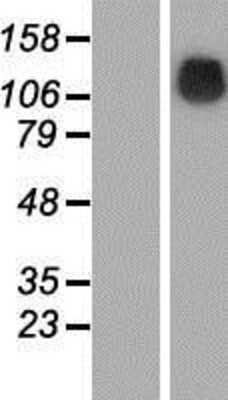 Western Blot: SRGAP1 Overexpression Lysate (Adult Normal) [NBP2-06611] Left-Empty vector transfected control cell lysate (HEK293 cell lysate); Right -Over-expression Lysate for SRGAP1.