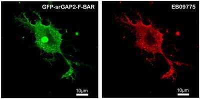 Immunocytochemistry/Immunofluorescence: SRGAP2 Antibody [NBP1-49877] - HEK293 overexpressing Human srGAP2 and probed with EB09775 at 2.5ug/ml in the right panel. Data kindly provided by Ms. Ya-Jing Mi and Dr.Wei-Lin Jin, Institute of Neurosciences, Shanghai Jiao Tong University.