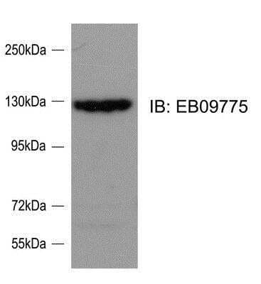 Western Blot: SRGAP2 Antibody [NBP1-49877] - (0.1ug/ml) staining of Rat Cortical Neuron lysate (35ug protein in RIPA buffer). Primary incubation was 1 hour. Detected by chemiluminescence. Data kindly provided by Ms. Ya-Jing Mi and Dr.Wei-Lin Jin, Institute of Neurosciences, Shanghai Jiao Tong Univer