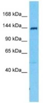 Western Blot: SRGAP2 Antibody [NBP3-09966] - Western blot analysis of SRGAP2 in 293T Whole Cell lysates. Antibody dilution at 1.0ug/ml