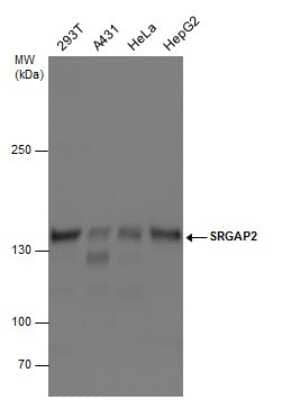 Western Blot: SRGAP2 Antibody [NBP3-12953] - Various whole cell extracts (30 ug) were separated by 5% SDS-PAGE, and the membrane was blotted with SRGAP2 antibody (NBP3-12953) diluted at 1:1000.