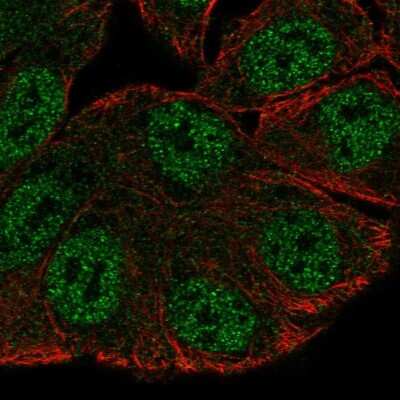 Immunocytochemistry/Immunofluorescence: SRGAP3 Antibody [NBP2-38521] - Immunofluorescent staining of human cell line RT4 shows localization to nucleoplasm.