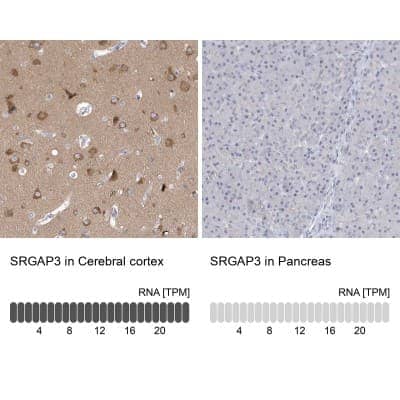 Immunohistochemistry-Paraffin: SRGAP3 Antibody [NBP1-88831] - Staining in human cerebral cortex and pancreas tissues using anti-SRGAP3 antibody. Corresponding SRGAP3 RNA-seq data are presented for the same tissues.