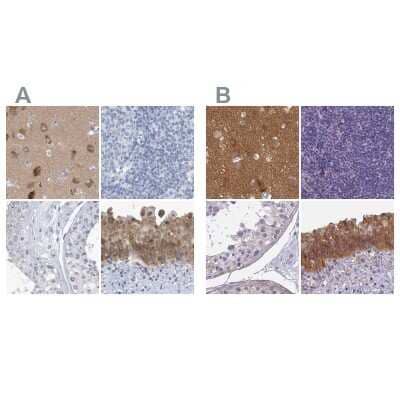 Immunohistochemistry-Paraffin: SRGAP3 Antibody [NBP1-88831] - Staining of human cerebral cortex, lymph node, testis and urinary bladder using Anti-SRGAP3 antibody NBP1-88831 (A) shows similar protein distribution across tissues to independent antibody NBP2-38521 (B).