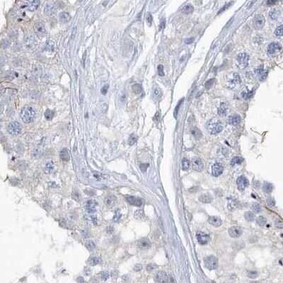 Immunohistochemistry-Paraffin: SRGAP3 Antibody [NBP1-88831] - Staining of human testis.