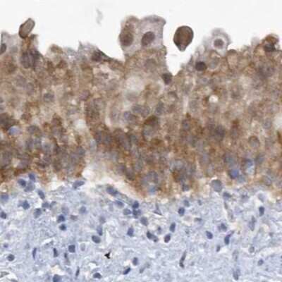 Immunohistochemistry-Paraffin: SRGAP3 Antibody [NBP1-88831] - Staining of human urinary bladder.