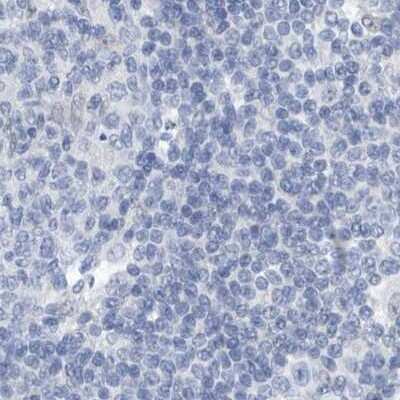 Immunohistochemistry-Paraffin: SRGAP3 Antibody [NBP1-88831] - Staining of human lymph node.