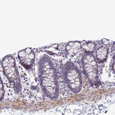 Immunohistochemistry-Paraffin: SRGAP3 Antibody [NBP2-38521] - Staining of human colon shows low expression as expected.