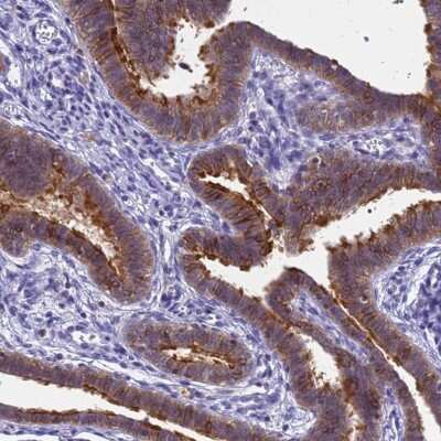 Immunohistochemistry-Paraffin: SRGAP3 Antibody [NBP2-38521] - Staining of human fallopian tube shows high expression.