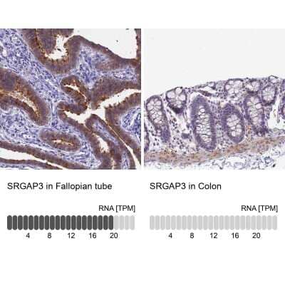 <b>Orthogonal Strategies Validation. </b>Immunohistochemistry-Paraffin: SRGAP3 Antibody [NBP2-38521] - Staining in human fallopian tube and colon tissues using anti-SRGAP3 antibody. Corresponding SRGAP3 RNA-seq data are presented for the same tissues.