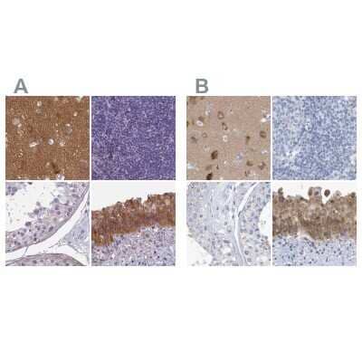 <b>Independent Antibodies Validation. </b>Immunohistochemistry-Paraffin: SRGAP3 Antibody [NBP2-38521] - Staining of human cerebral cortex, lymph node, testis and urinary bladder using Anti-SRGAP3 antibody NBP2-38521 (A) shows similar protein distribution across tissues to independent antibody NBP1-88831 (B).