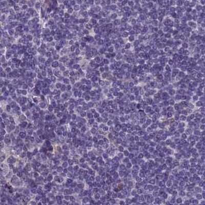 Immunohistochemistry-Paraffin: SRGAP3 Antibody [NBP2-38521] - Staining of human lymph node.