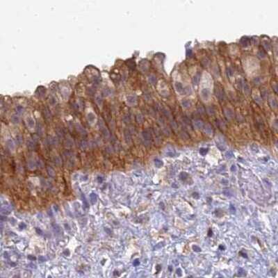 Immunohistochemistry-Paraffin: SRGAP3 Antibody [NBP2-38521] - Staining of human urinary bladder.