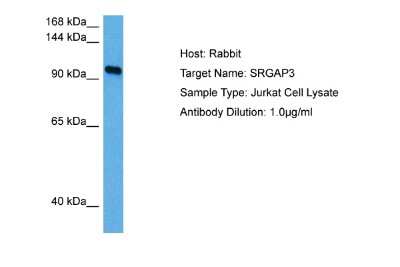 Western Blot: SRGAP3 Antibody [NBP2-85818] - Host: Rabbit. Target Name: SRGAP3. Sample Tissue: Human Jurkat Whole Cell lysates. Antibody Dilution: 1ug/ml