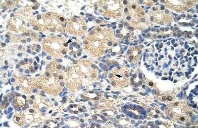 Immunohistochemistry-Paraffin SRP14 Antibody