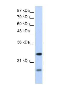 Western Blot SRP14 Antibody