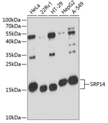 Western Blot SRP14 Antibody - Azide and BSA Free