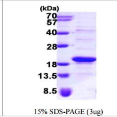 SDS-PAGE Recombinant Human SRP14 His Protein