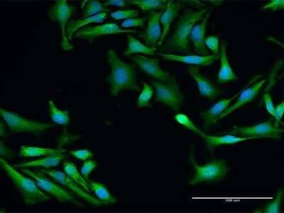 Immunocytochemistry/Immunofluorescence: SRP19 Antibody [H00006728-D01P] - Analysis of antibody to SRP19 on HeLa cell. Antibody concentration 30 ug/ml.