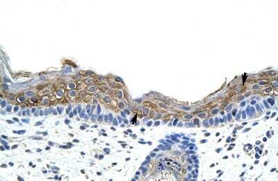 Immunohistochemistry-Paraffin: SRP19 Antibody [NBP1-57425] - Human Skin Tissue Squamous epithelial cells (Indicated with Arrows), 4-8ug/ml.