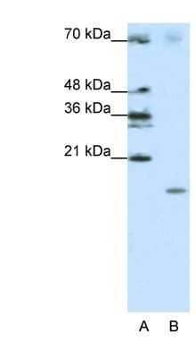 Western Blot: SRP19 Antibody [NBP1-57425] - Titration: 1.25ug/ml, Positive Control: Jurkat cell lysate.