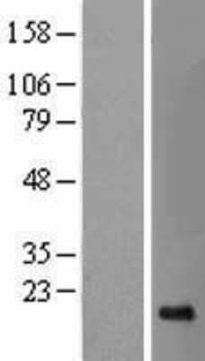 Western Blot: SRP19 Overexpression Lysate (Adult Normal) [NBL1-16453] Left-Empty vector transfected control cell lysate (HEK293 cell lysate); Right -Over-expression Lysate for SRP19.