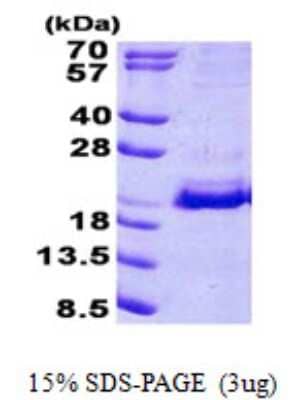 SDS-Page: SRP19 Protein [NBP2-23473]